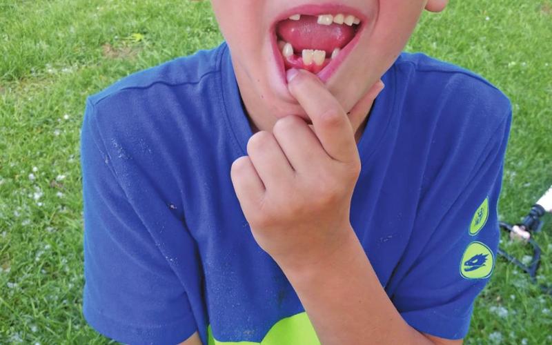 Jasper Halverson lost a tooth and compared it to the hail. Photo submitted by Bryanna Halvorson