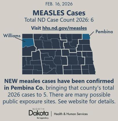 Measles cases confi rmed in North Dakota as health offi cials warn of possible community spread