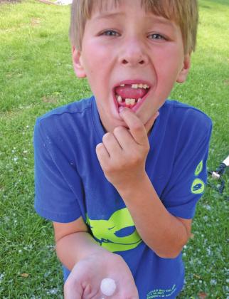 Jasper Halverson lost a tooth and compared it to the hail. Photo submitted by Bryanna Halvorson