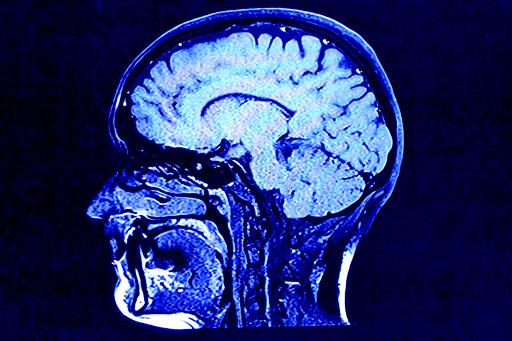 By making brain health a priority when coming up with New Year's resolutions this year, individuals can benefit for years to come.