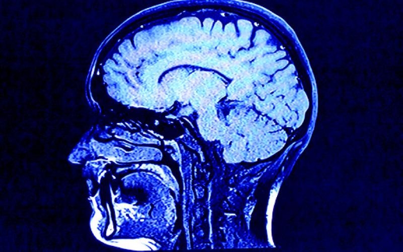 By making brain health a priority when coming up with New Year's resolutions this year, individuals can benefit for years to come.