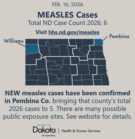 Measles cases confi rmed in North Dakota as health offi cials warn of possible community spread
