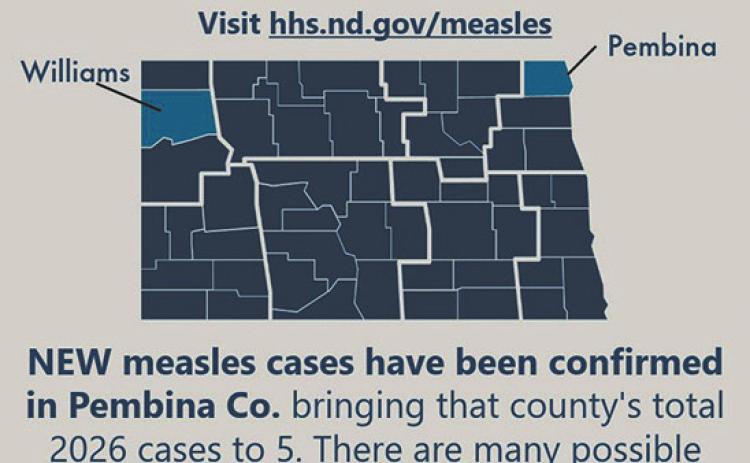 Measles cases confi rmed in North Dakota as health offi cials warn of possible community spread